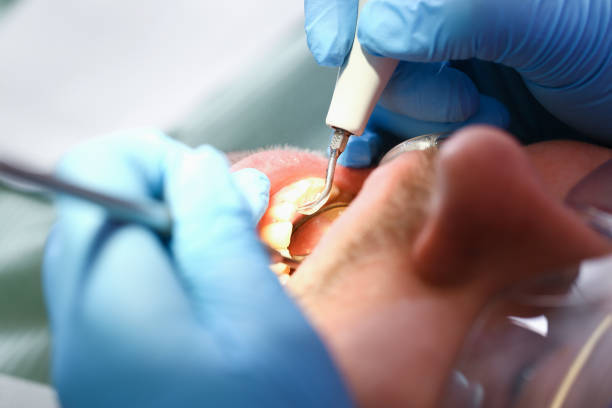 Best Broken or Chipped Tooth Repair in Highland Village, TX