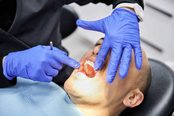 Best Emergency Wisdom Tooth Extraction in Highland Village, TX